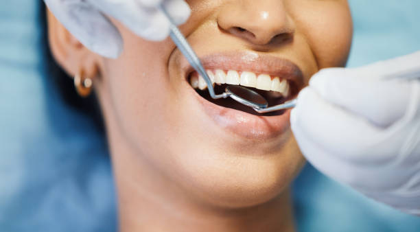 Best Emergency Tooth Extraction in Bridgman, MI