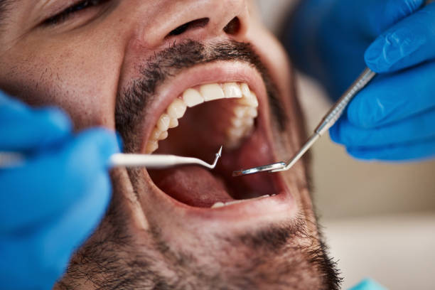 Best Pediatric Emergency Dentist in Bridgman, MI