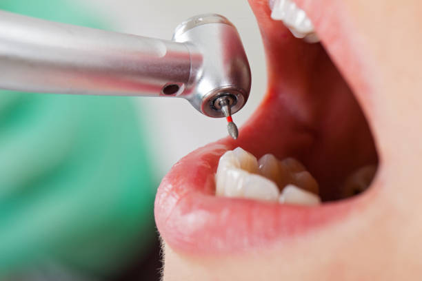 Best Emergency TMJ Treatment in Bridgman, MI